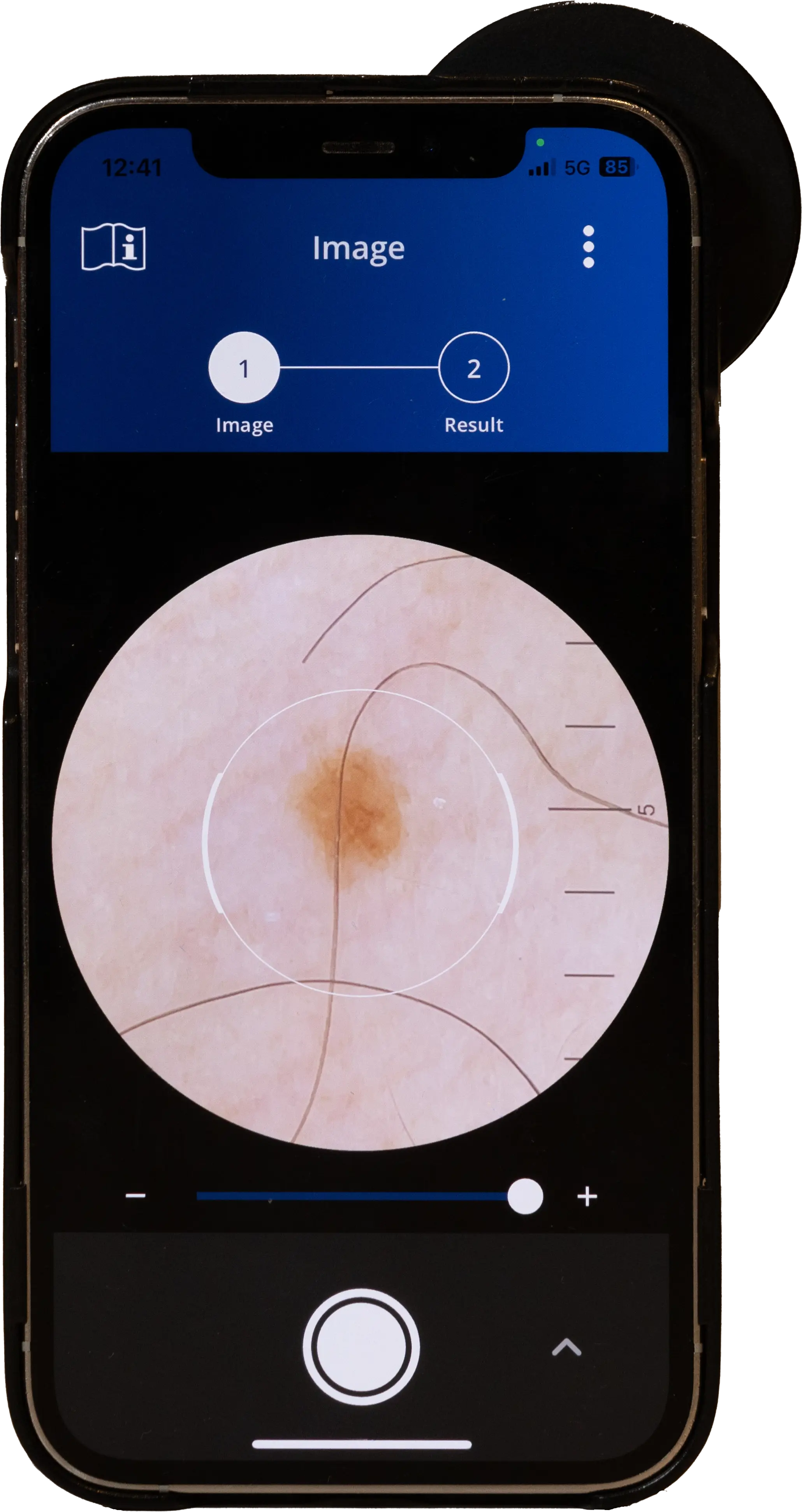 Clinical Validation Results
